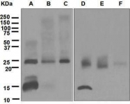 GTX63241 - TNF-beta / Lymphotoxin-alpha