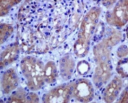 GTX63542 - Lanosterol synthase