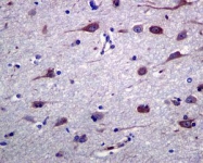 GTX63562 - Tyrosine-protein kinase RYK