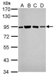 GTX70147 - DNA ligase 3