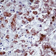 GTX73373 - Herpes simplex Virus 1 / HSV1