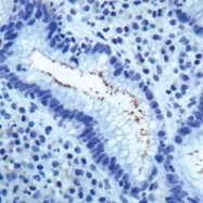 GTX73544 - Helicobacter pylori