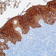 GTX73583 - pan Cytokeratin