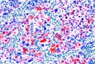 GTX73669 - basic Cytokeratin