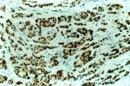 GTX73914 - Estrogen receptor alpha