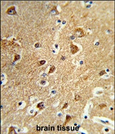 GTX80567 - Protein phosphatase 1H / PPM1H