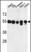 GTX80567 - Protein phosphatase 1H / PPM1H