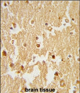 GTX80586 - Estrogen-related receptor beta