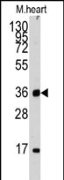 GTX81220 - Unc-51-like kinase 3 (ULK3)