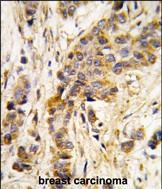 GTX81278 - Isoleucyl-tRNA synthetase / IARS2