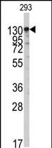 GTX81278 - Isoleucyl-tRNA synthetase / IARS2