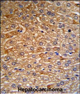 GTX81528 - Histidine-rich glycoprotein / HRG