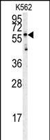 GTX81528 - Histidine-rich glycoprotein / HRG