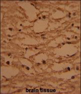 GTX81789 - HIV Tat-specific factor 1 / HTATSF1