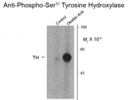 GTX82569 - Tyrosine 3-monooxygenase (TH)