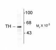 GTX82570 - Tyrosine 3-monooxygenase (TH)