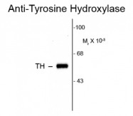 GTX82571 - Tyrosine 3-monooxygenase (TH)