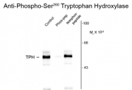 GTX82573 - Tryptophan 5-hydroxylase 1 (TPH1)