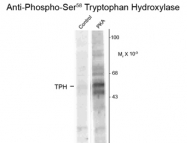 GTX82574 - Tryptophan 5-hydroxylase 1 (TPH1)