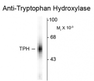 GTX82575 - Tryptophan 5-hydroxylase 1 (TPH1)