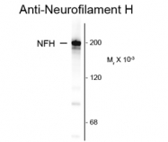 GTX82647 - Neurofilament H (200 kD)