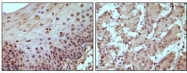 GTX83384 - Retinoblastoma-associated protein / RB1
