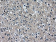 GTX84317 - Isocitric dehydrogenase alpha / IDH3A