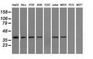 GTX84317 - Isocitric dehydrogenase alpha / IDH3A