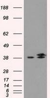GTX84317 - Isocitric dehydrogenase alpha / IDH3A