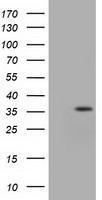 GTX84318 - Isocitric dehydrogenase alpha / IDH3A