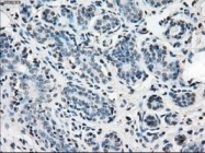 GTX84319 - Isocitrate dehydrogenase / IDH