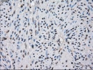 GTX84319 - Isocitrate dehydrogenase / IDH
