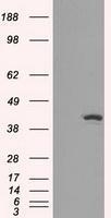 GTX84319 - Isocitrate dehydrogenase / IDH