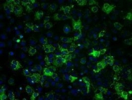 GTX84841 - ATP synthase subunit beta