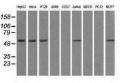 GTX84842 - ATP synthase subunit beta