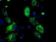 GTX84843 - ATP synthase subunit beta