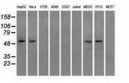 GTX84844 - ATP synthase subunit beta