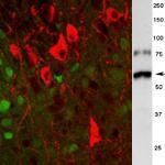 GTX85470 - Tyrosine 3-monooxygenase (TH)