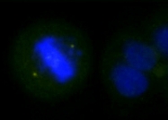 GTX85609 - Aurora kinase A