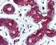 GTX85818 - Tumor protein D53 (TPD52L1)