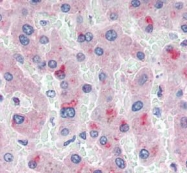 GTX85859 - Apolipoprotein(a) / LP(a)
