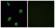 GTX87085 - Serotonin receptor 5B (HTR5B)
