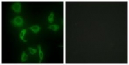 GTX87187 - Isoleucyl-tRNA synthetase / IARS2