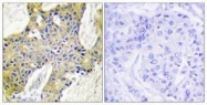 GTX87187 - Isoleucyl-tRNA synthetase / IARS2