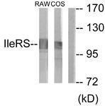 GTX87187 - Isoleucyl-tRNA synthetase / IARS2