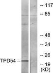 GTX87379 - Tumor protein D54 (TPD52L2)