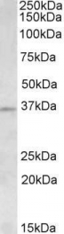 GTX88135 - Aurora kinase C