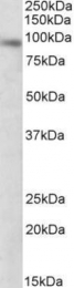 GTX88228 - DTX3 / RNF154