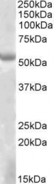 GTX88229 - EYA1