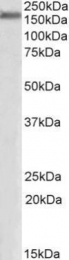 GTX88275 - ZO-1 / Tight junction protein 1